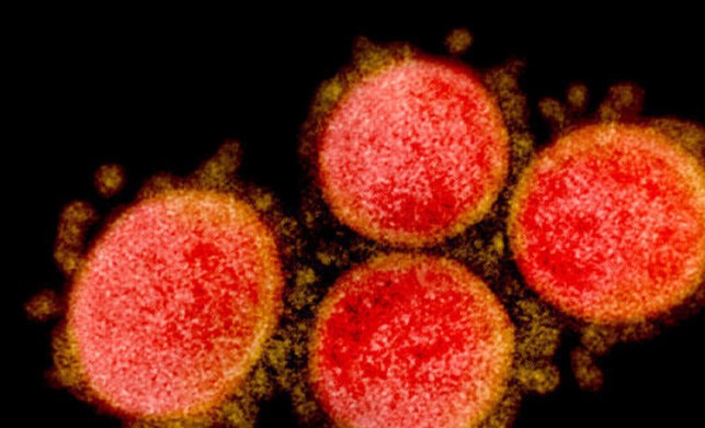 Dünya Sağlık Örgütü koronavirüsün hava yoluyla bulaşmadığını açıkladı